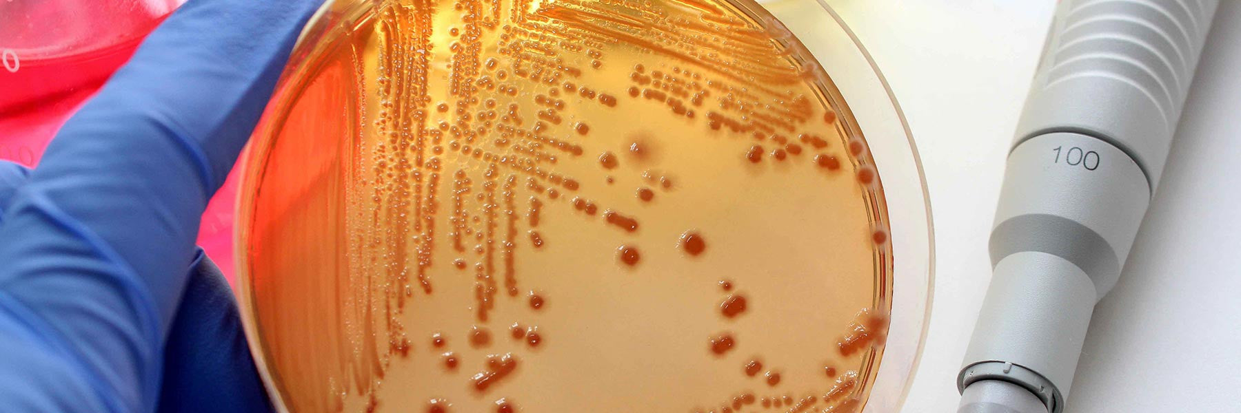 Microbiological Monitoring